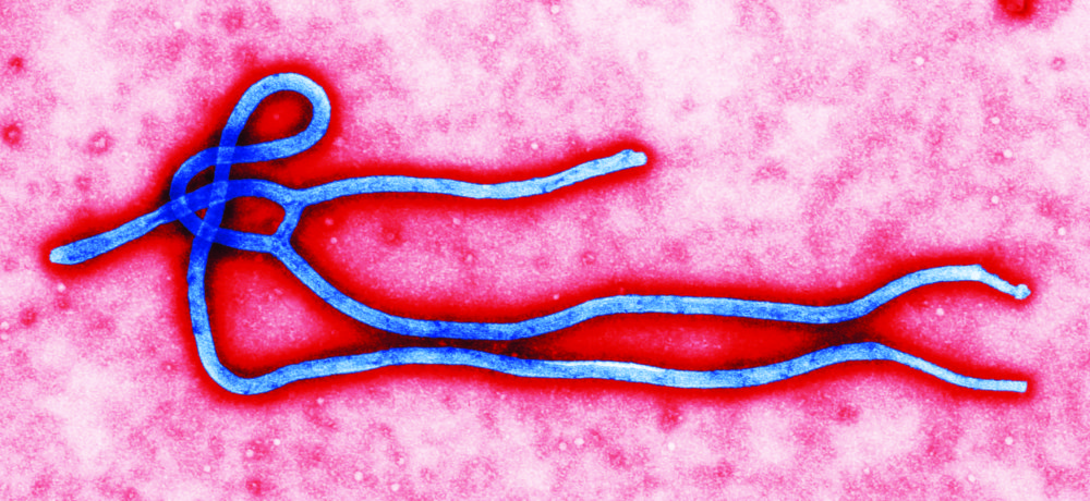 Ebola Fast Facts